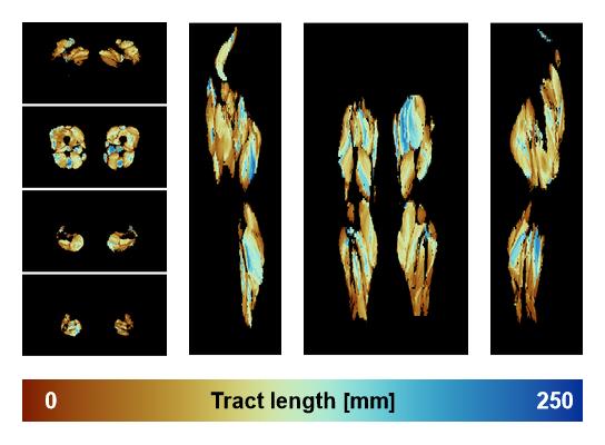 Muscle fiber tract length map based on whole leg DTI based fiber tractography.