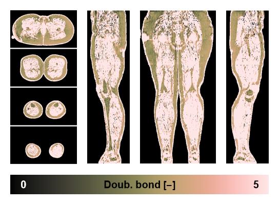 Number of double bonds in subcutanious fat.