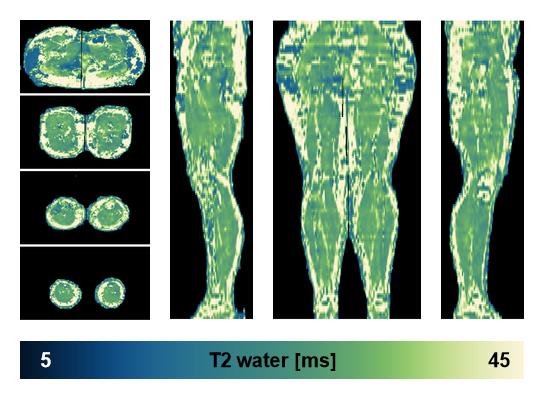 The water only T2 relaxation time of the lower extremity obtained from multi echo spin echo t2 mapping with EPG based reconstruction.