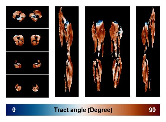 Muscle fiber tract angle map based on whole leg DTI based fiber tractography.