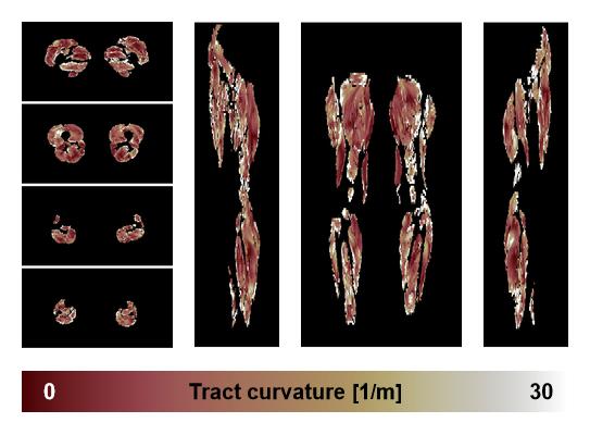 Muscle fiber tract curvature map based on whole leg DTI based fiber tractography.