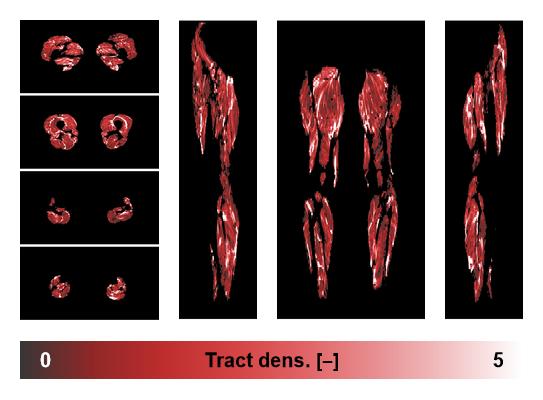 Muscle fiber tract density map based on whole leg DTI based fiber tractography.