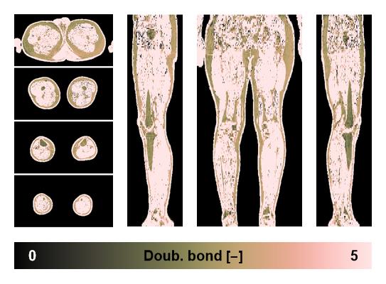 Number of double bonds in subcutanious fat.