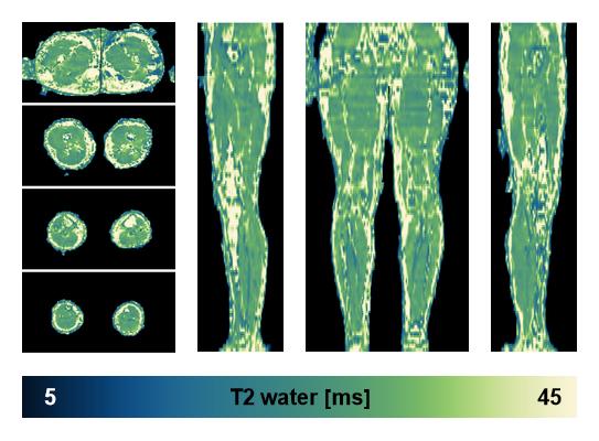 The water only T2 relaxation time of the lower extremity obtained from multi echo spin echo t2 mapping with EPG based reconstruction.