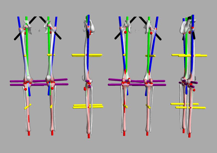 3D render of automated bone segmentation and force lines.