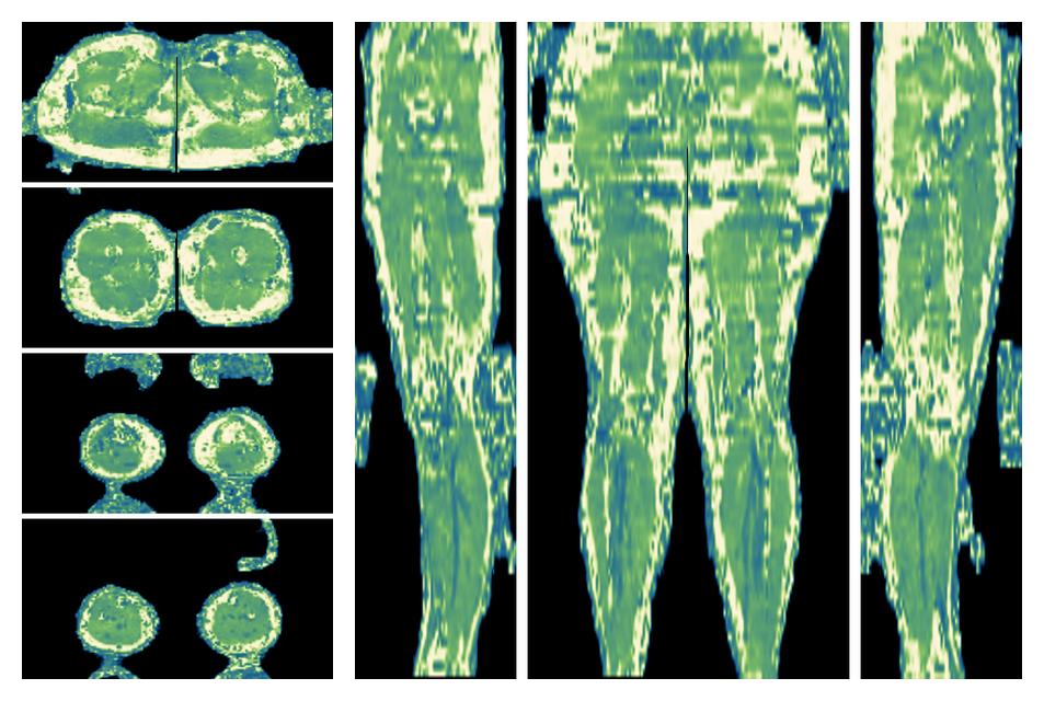 The water only T2 relaxation time of the lower extremity obtained from multi echo spin echo t2 mapping with EPG based reconstruction.