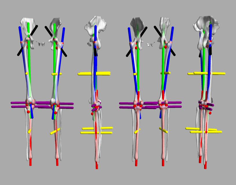 3D render of automated bone segmentation and force lines.