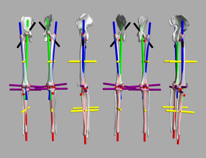 3D render of automated bone segmentation and force lines.