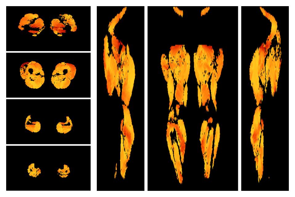 Muscle fiber tract angle map based on whole leg DTI based fiber tractography.