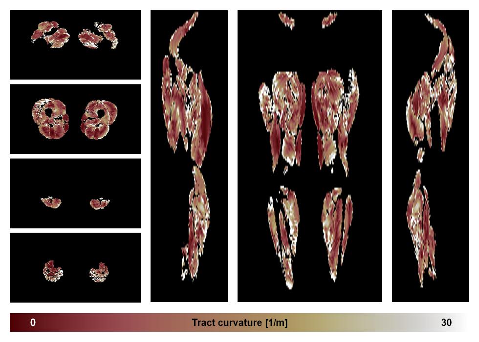 Muscle fiber tract curvature map based on whole leg DTI based fiber tractography.