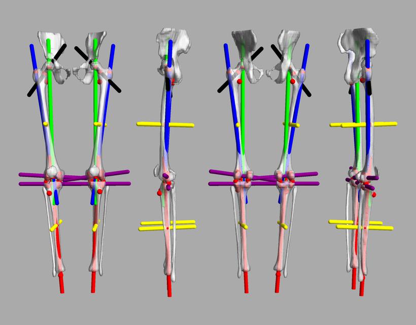 3D render of automated bone segmentation and force lines.