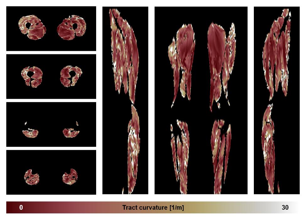 Muscle fiber tract curvature map based on whole leg DTI based fiber tractography.