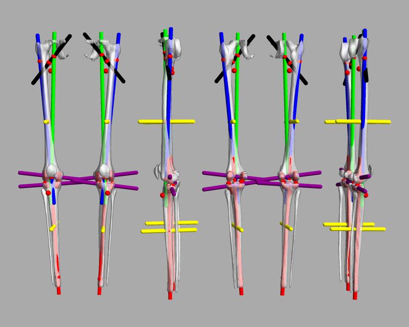 3D render of automated bone segmentation and force lines.