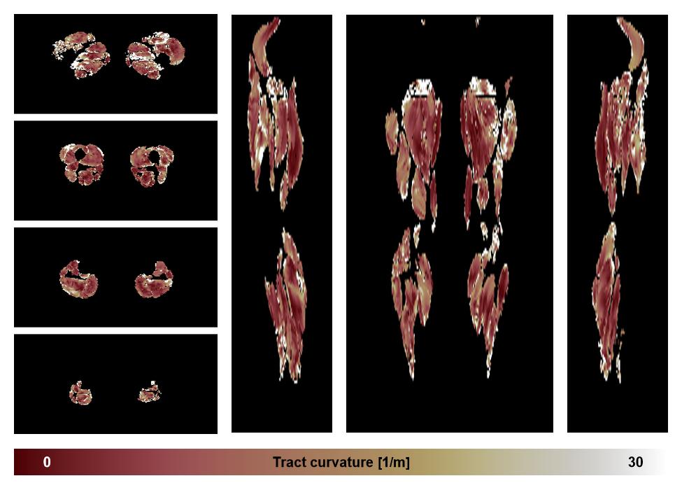 Muscle fiber tract curvature map based on whole leg DTI based fiber tractography.