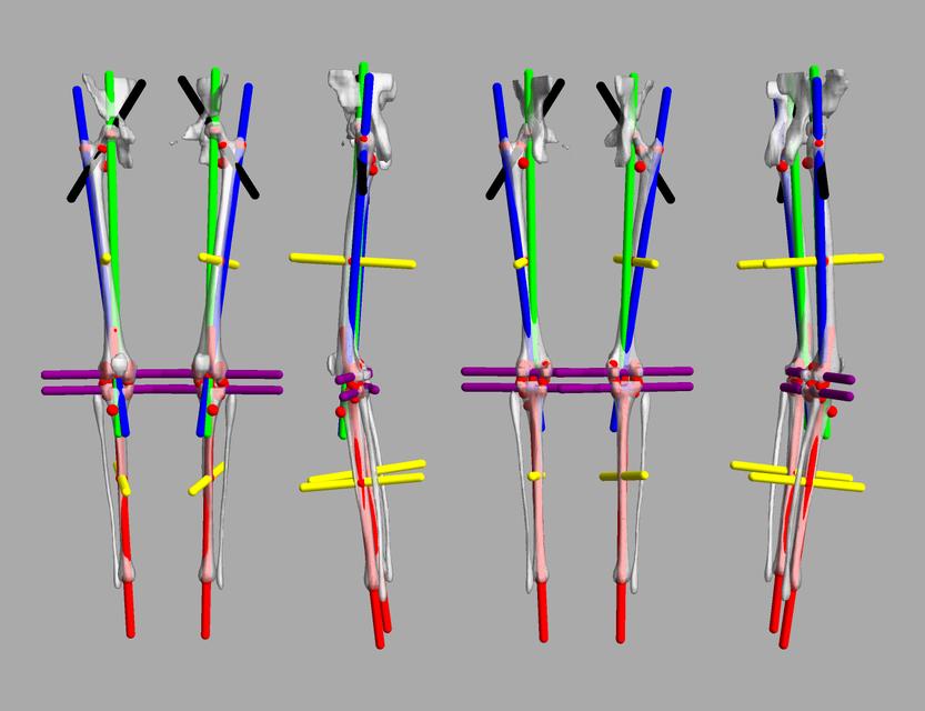 3D render of automated bone segmentation and force lines.