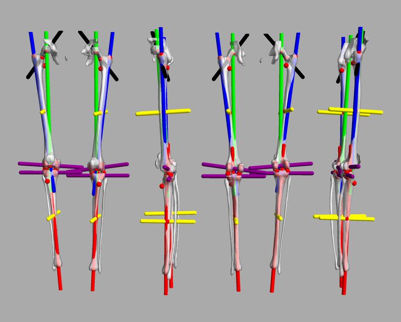 3D render of automated bone segmentation and force lines.