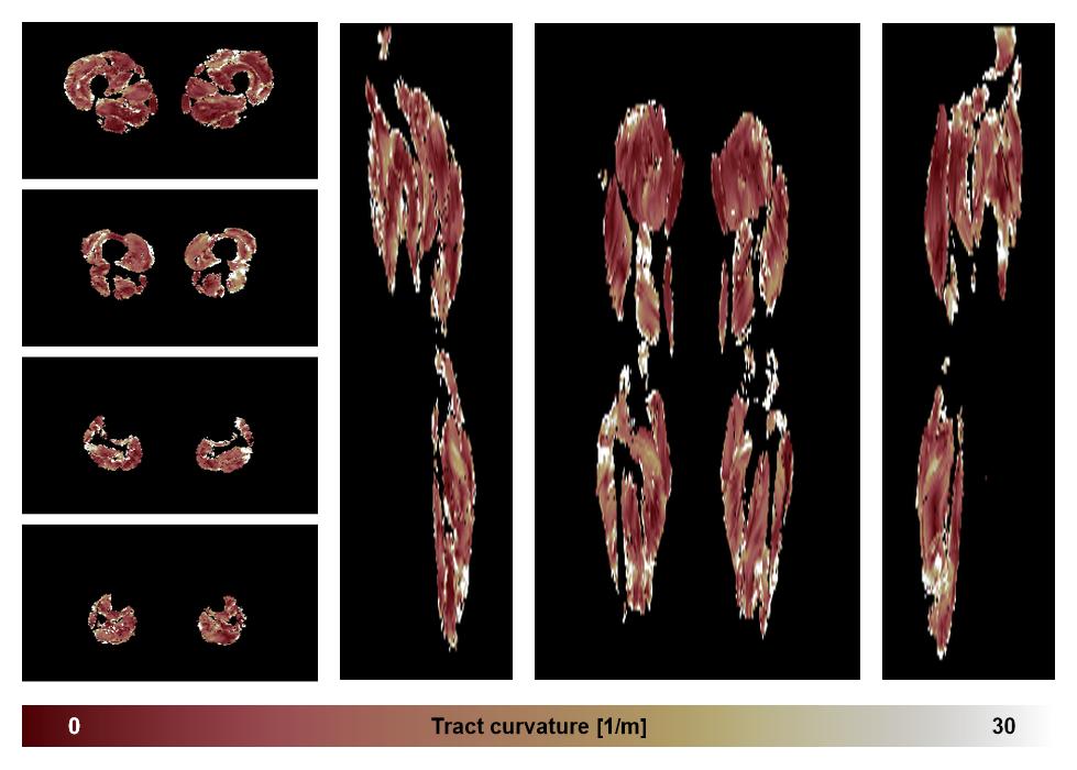 Muscle fiber tract curvature map based on whole leg DTI based fiber tractography.