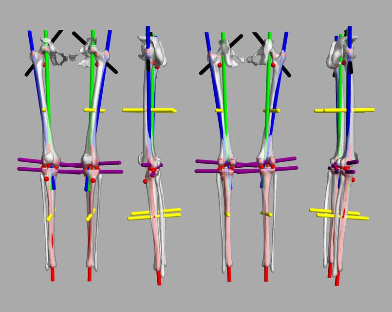 3D render of automated bone segmentation and force lines.