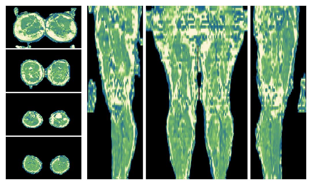 The water only T2 relaxation time of the lower extremity obtained from multi echo spin echo t2 mapping with EPG based reconstruction.