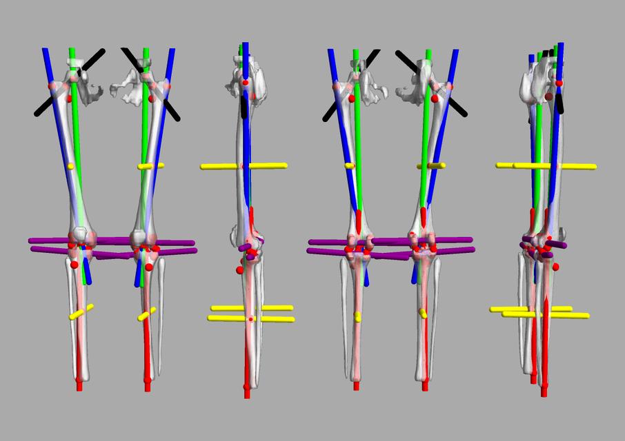 3D render of automated bone segmentation and force lines.