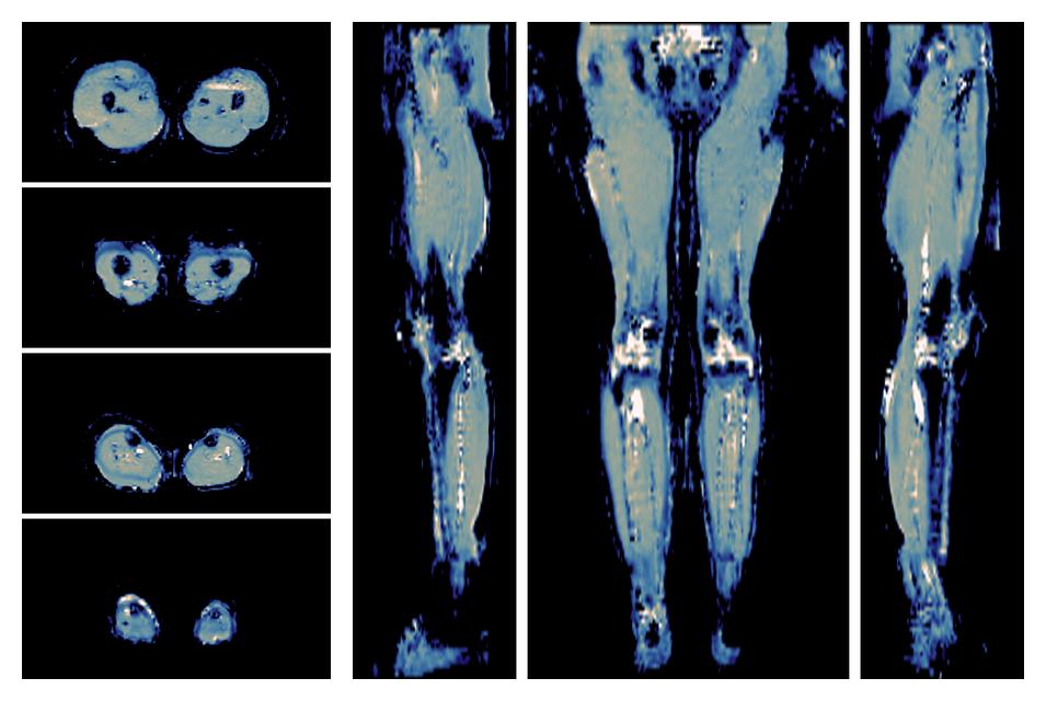 IVIM corrected whole leg muscle mean diffusivity obtained from diffusion tensor imaging.