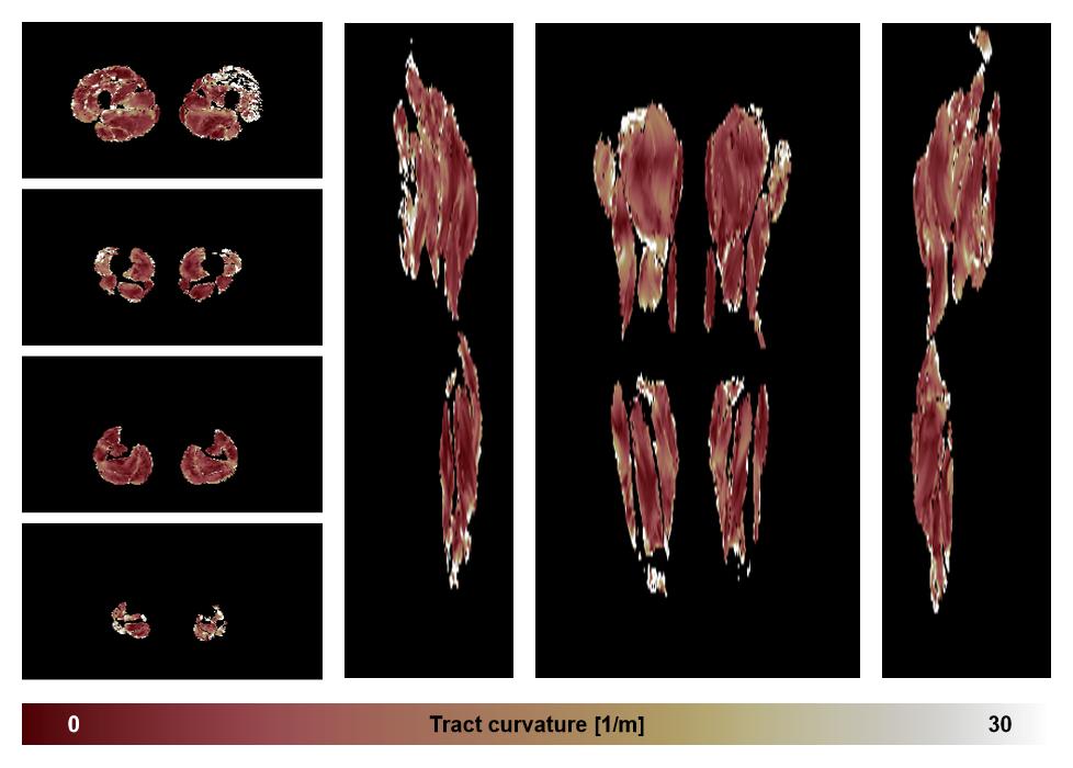 Muscle fiber tract curvature map based on whole leg DTI based fiber tractography.