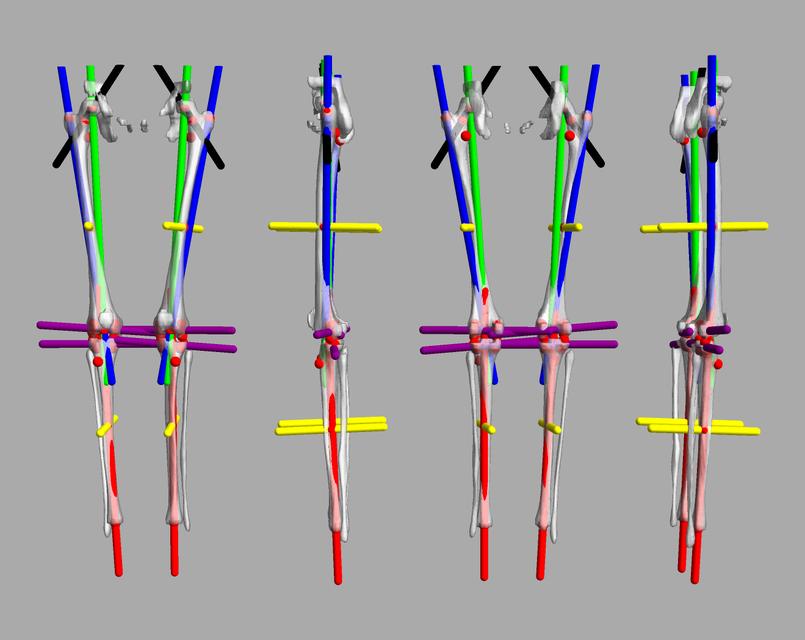 3D render of automated bone segmentation and force lines.