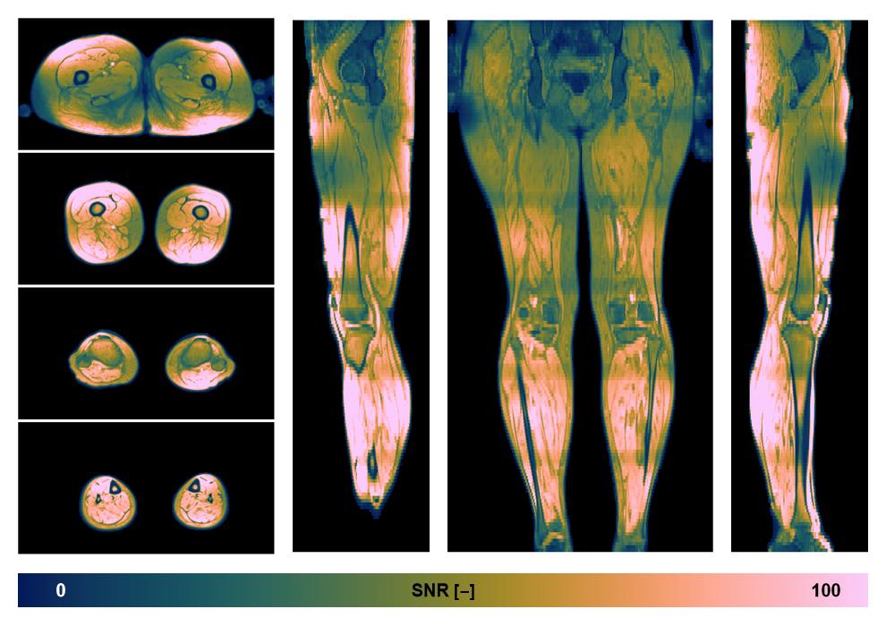 The SNR distribution of the dixon data.