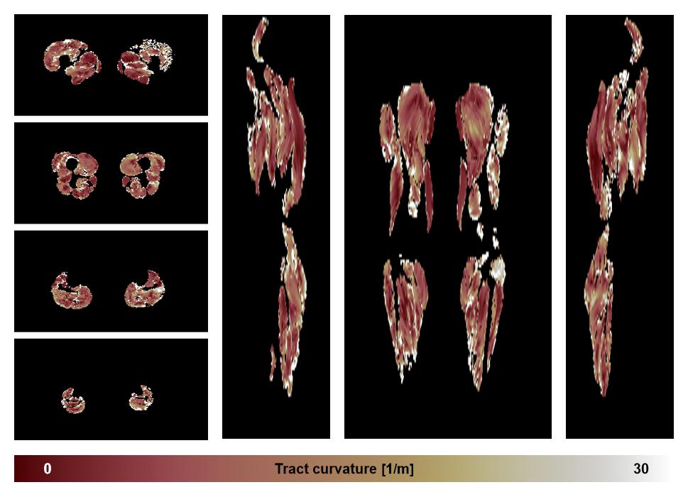 Muscle fiber tract curvature map based on whole leg DTI based fiber tractography.