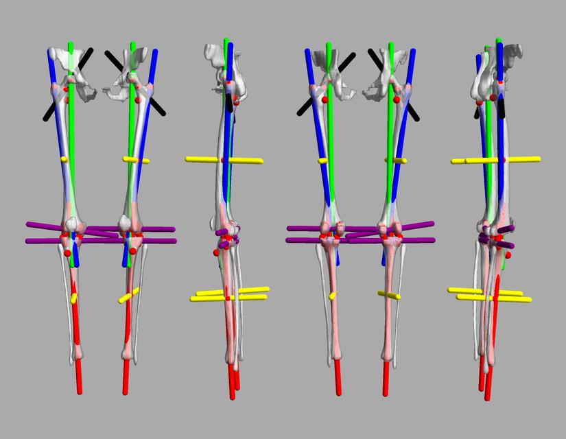 3D render of automated bone segmentation and force lines.