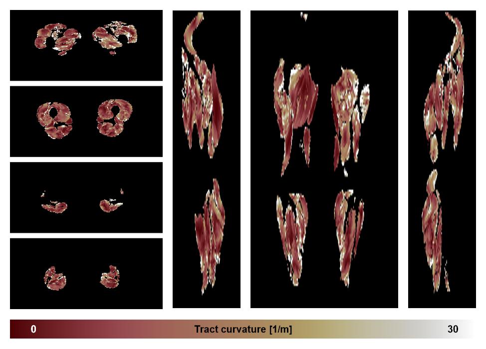 Muscle fiber tract curvature map based on whole leg DTI based fiber tractography.