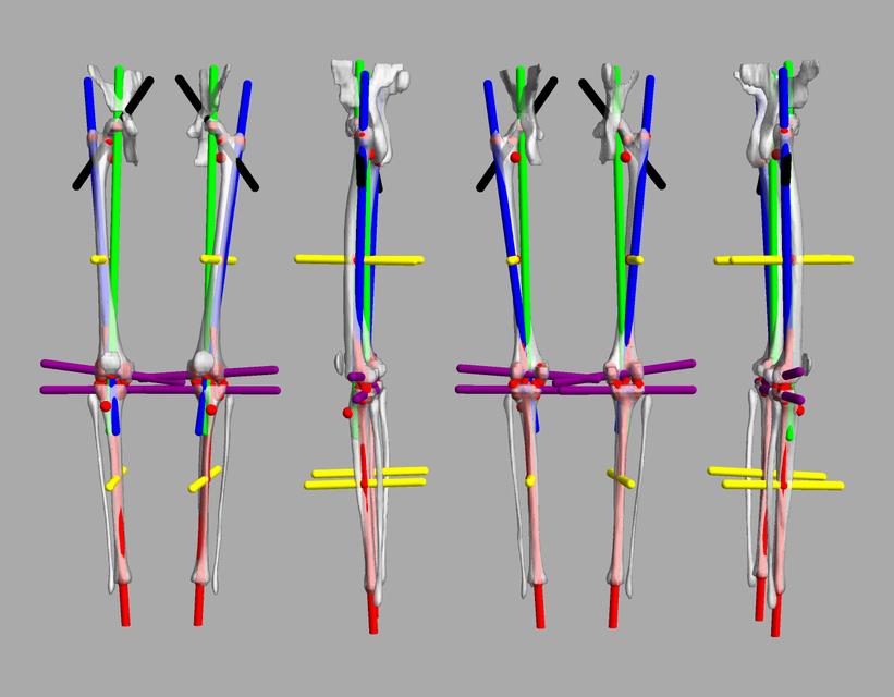 3D render of automated bone segmentation and force lines.