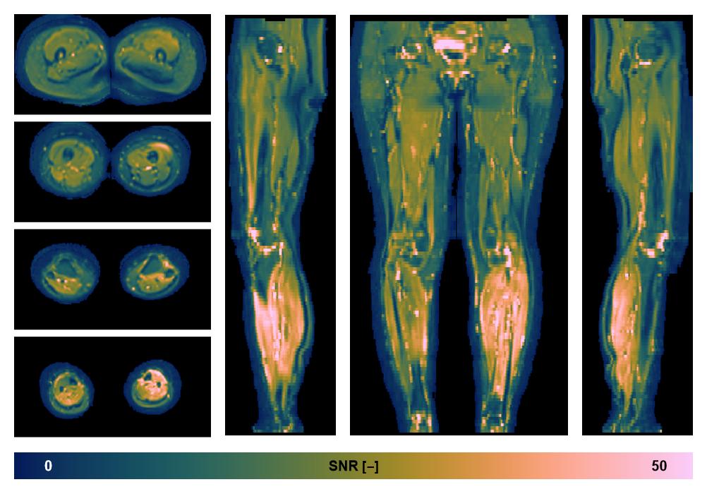 SNR distribution of the unweighted diffusion data.