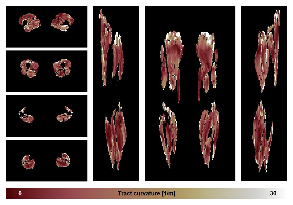 Muscle fiber tract curvature map based on whole leg DTI based fiber tractography.