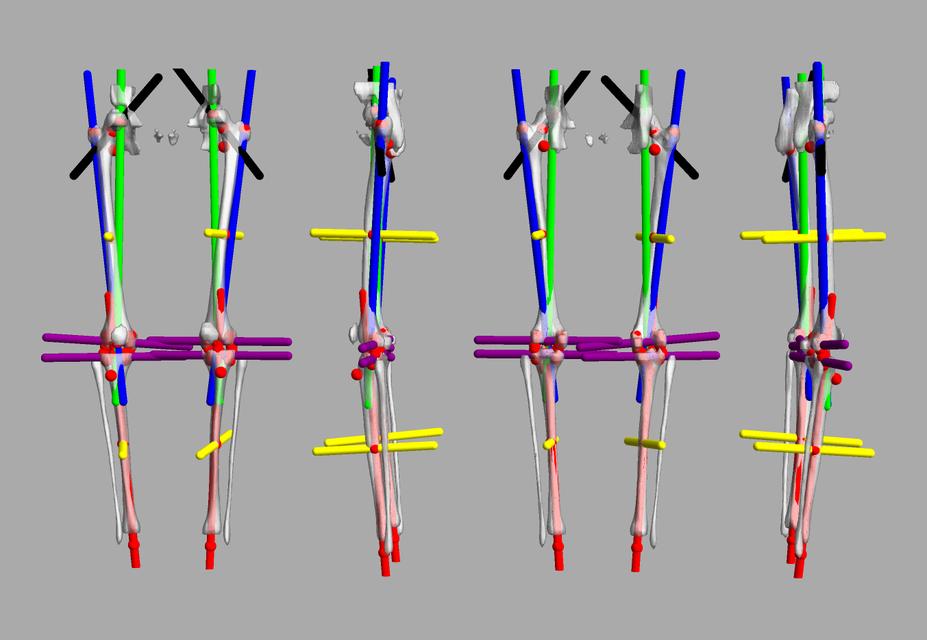 3D render of automated bone segmentation and force lines.