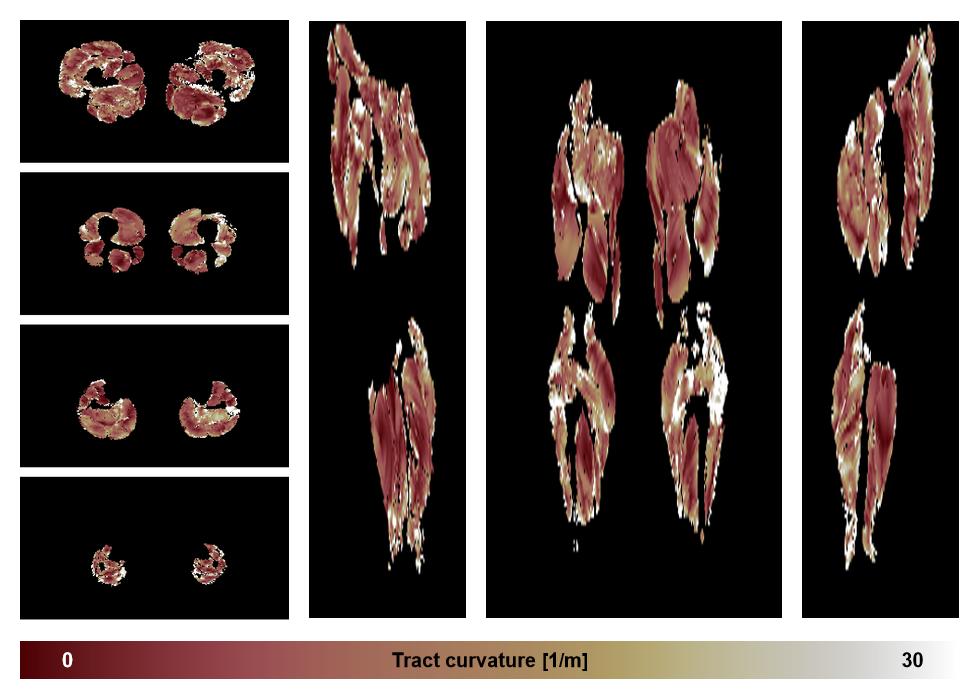 Muscle fiber tract curvature map based on whole leg DTI based fiber tractography.