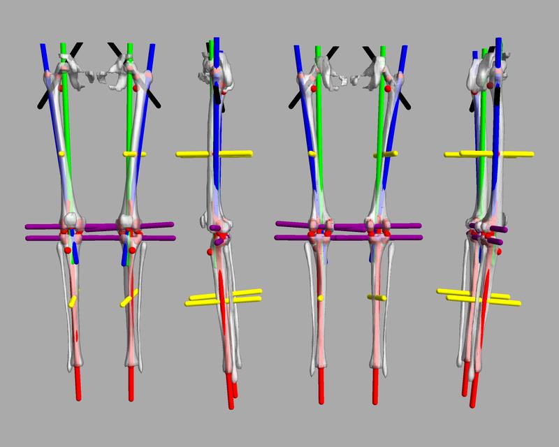 3D render of automated bone segmentation and force lines.