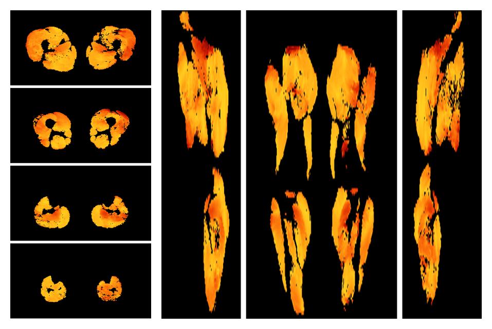 Muscle fiber tract angle map based on whole leg DTI based fiber tractography.