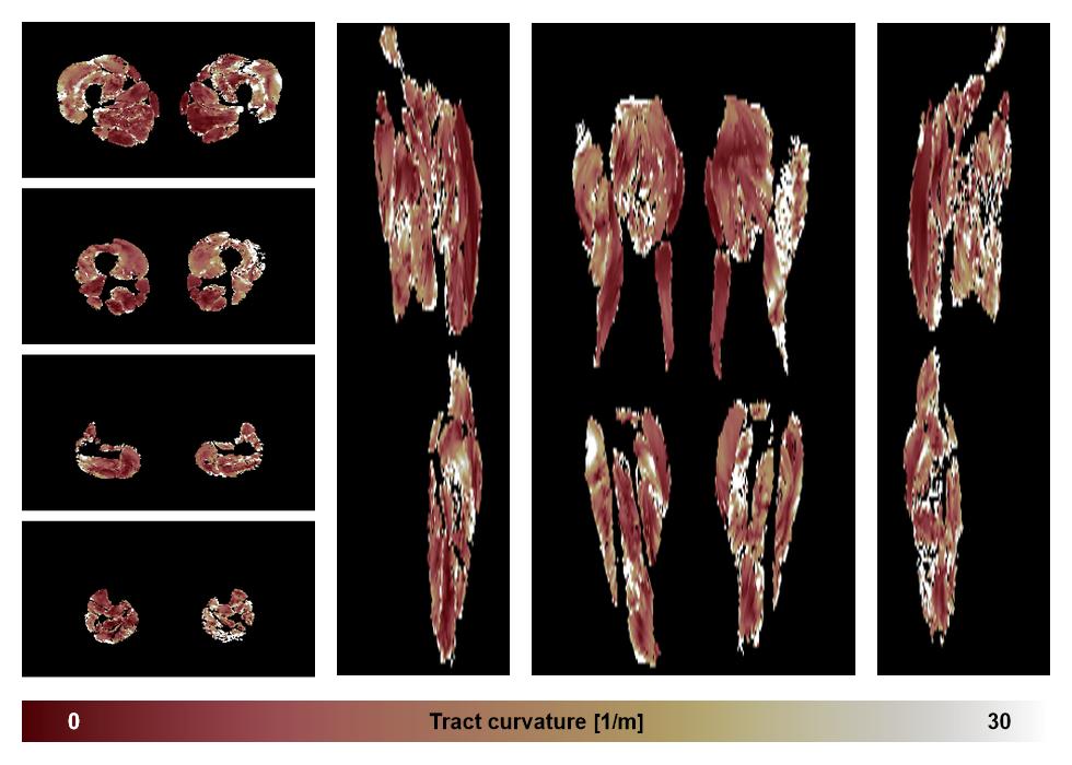 Muscle fiber tract curvature map based on whole leg DTI based fiber tractography.