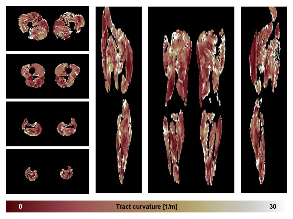 Muscle fiber tract curvature map based on whole leg DTI based fiber tractography.