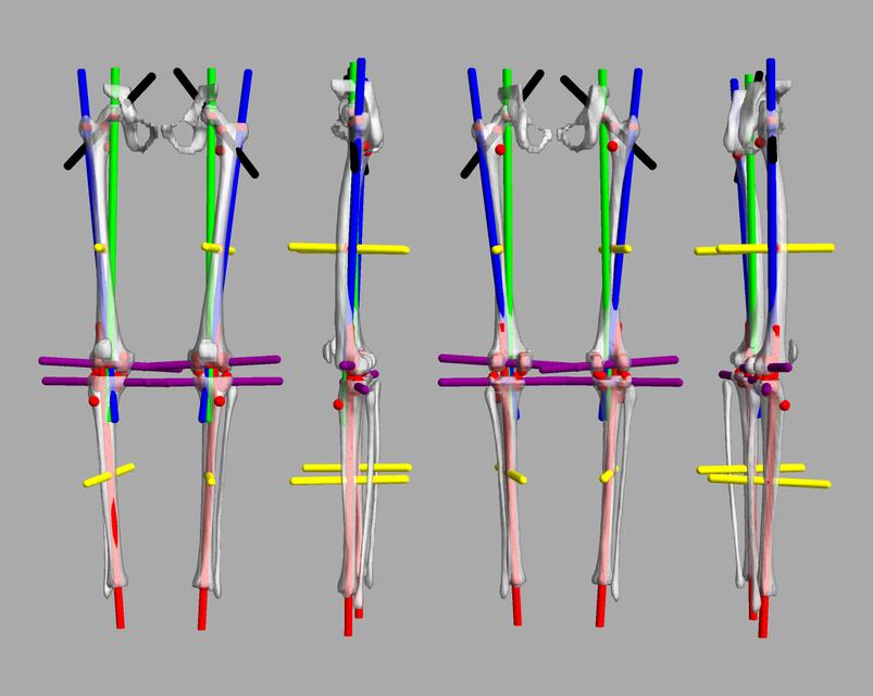 3D render of automated bone segmentation and force lines.