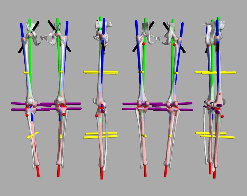 3D render of automated bone segmentation and force lines.