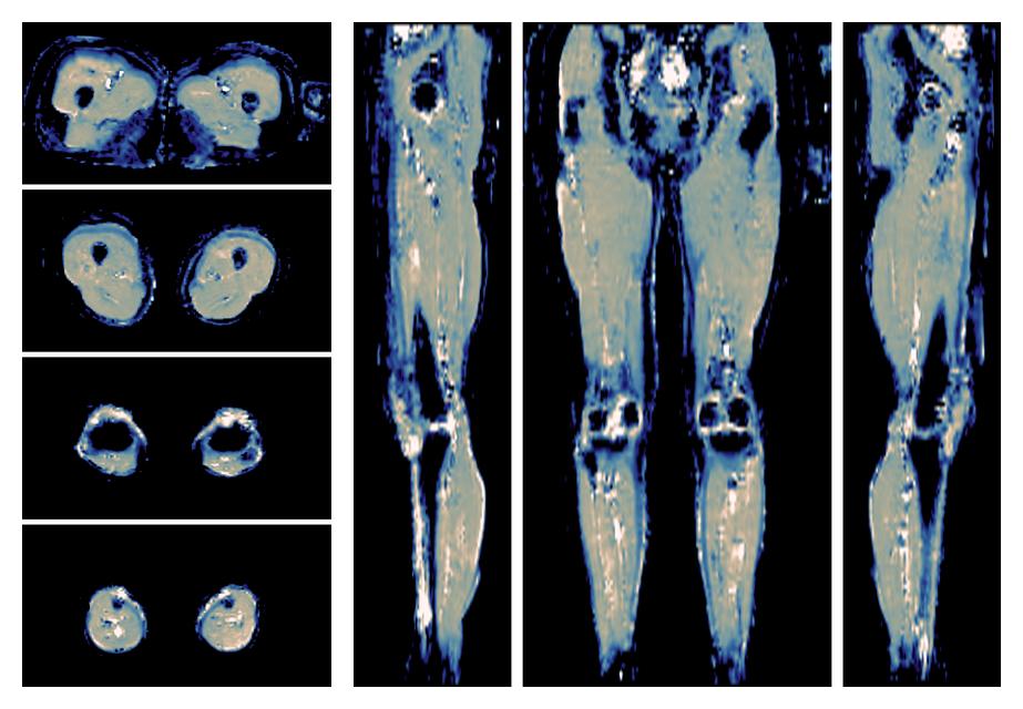 IVIM corrected whole leg muscle mean diffusivity obtained from diffusion tensor imaging.