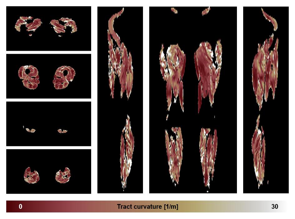 Muscle fiber tract curvature map based on whole leg DTI based fiber tractography.