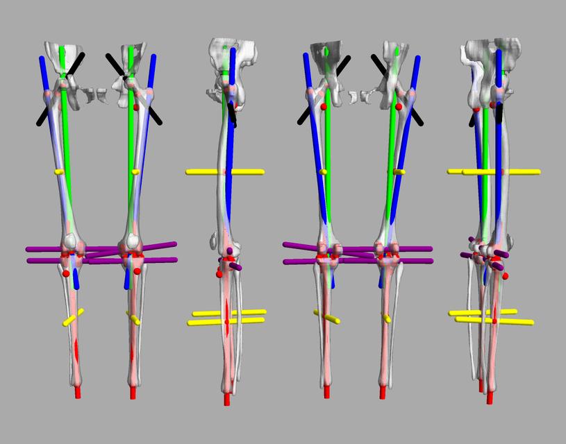 3D render of automated bone segmentation and force lines.