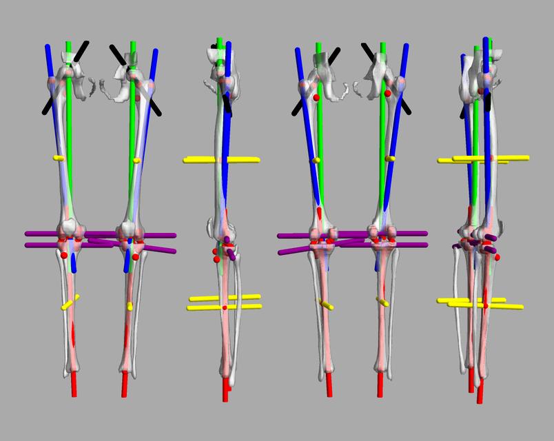 3D render of automated bone segmentation and force lines.