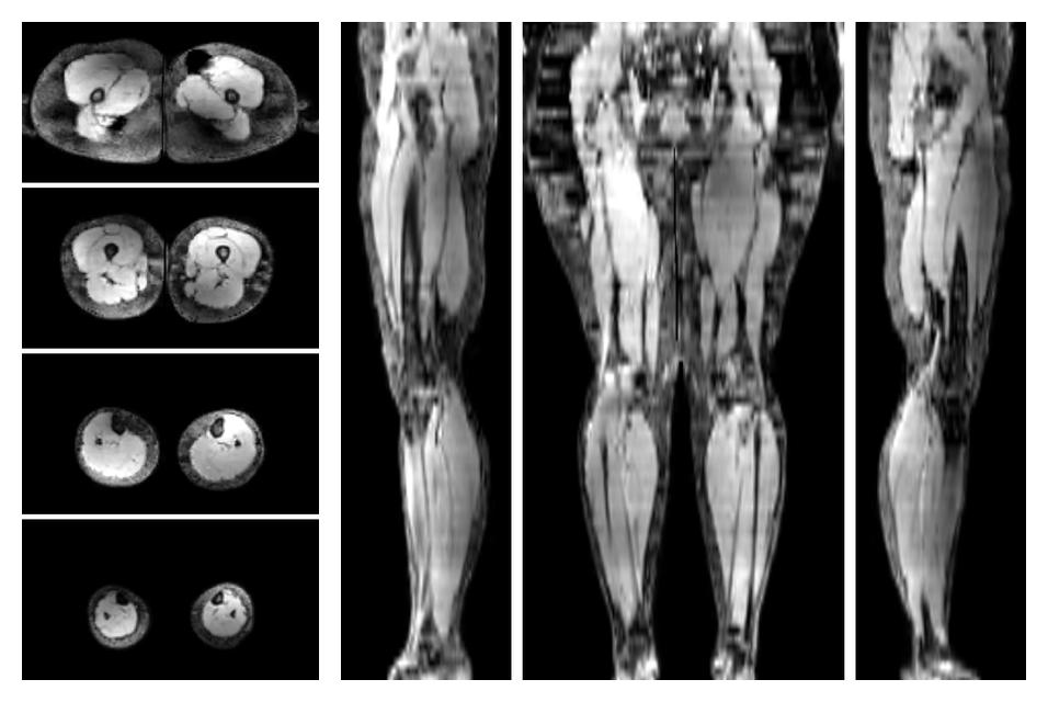 The water part of the acquired multi-echo spin echo data.