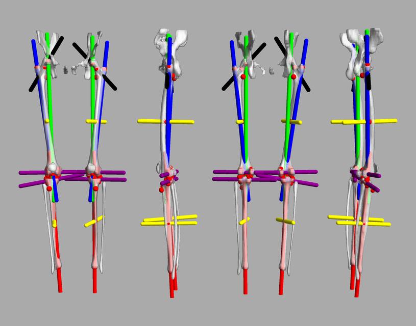 3D render of automated bone segmentation and force lines.