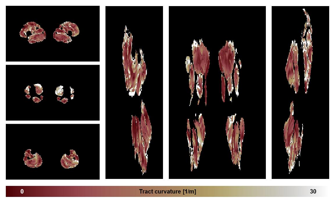 Muscle fiber tract curvature map based on whole leg DTI based fiber tractography.