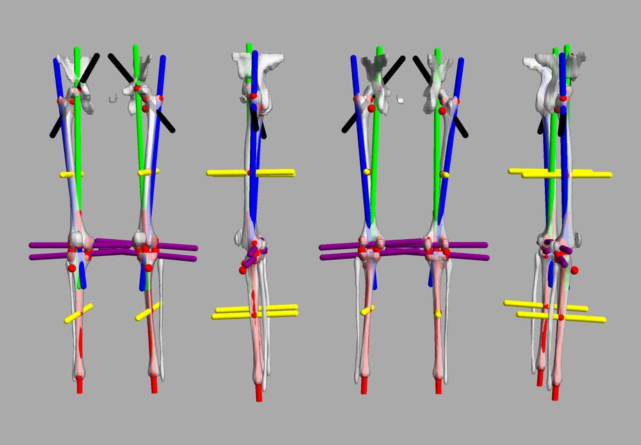 3D render of automated bone segmentation and force lines.